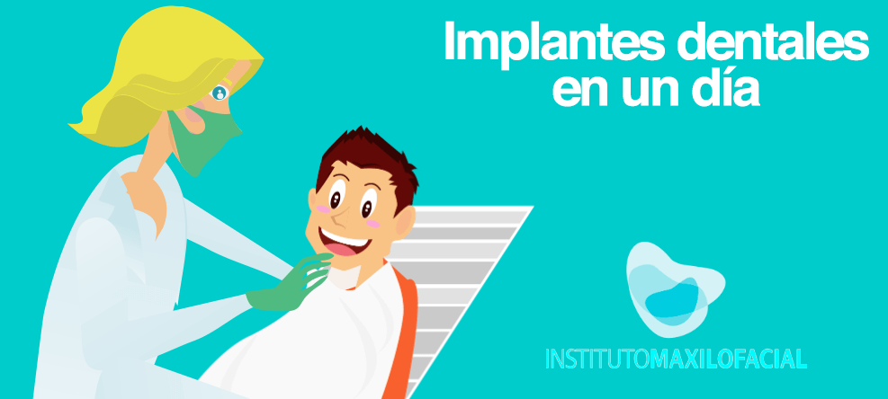 Implantes dentales inmediatos en un día, ¿es posible?
