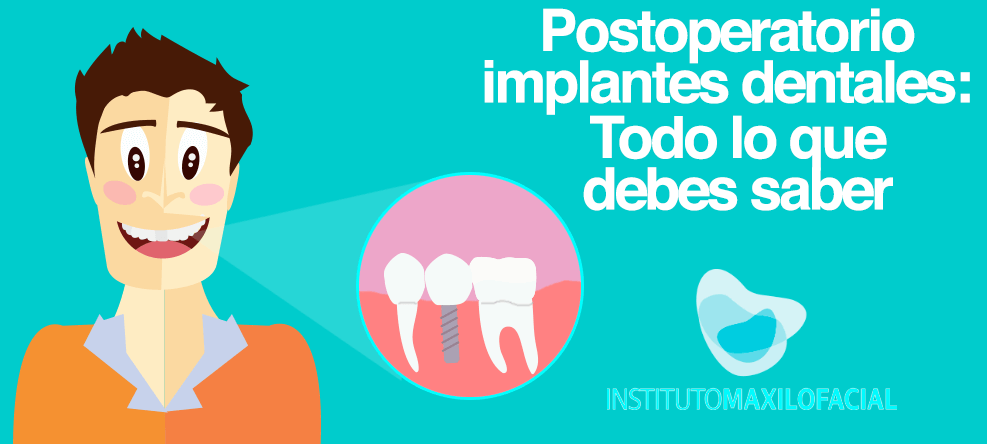 Postoperatorio implantes dentales