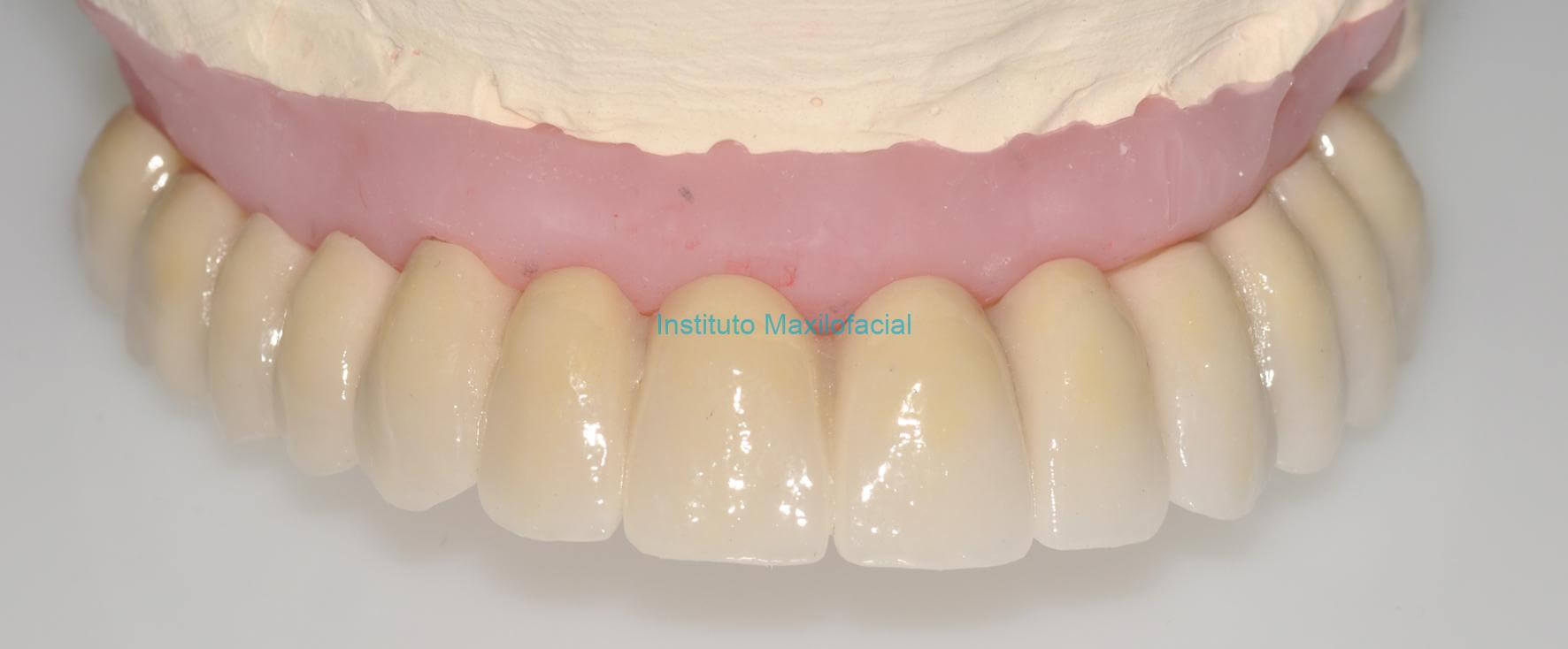 Abdominoplastia - Imaxilofacial Badajoz